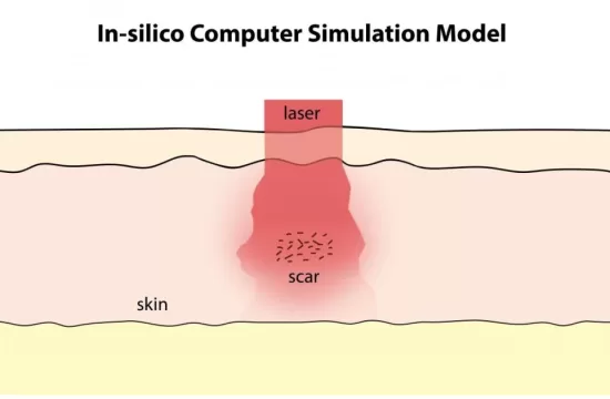 insilico computer simulation model