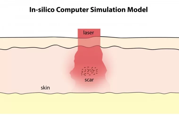 insilico computer simulation model