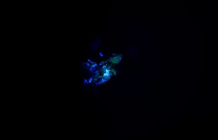 brain organoid 1