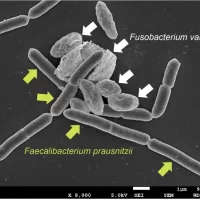 fusobactorium
