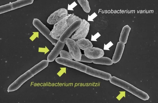 fusobactorium
