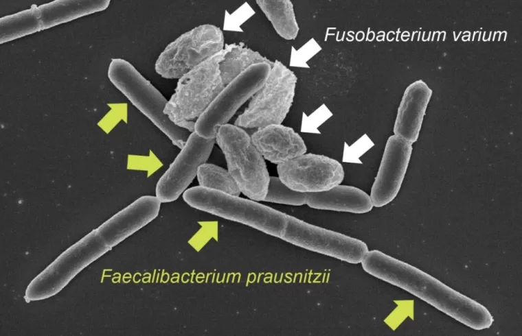fusobactorium