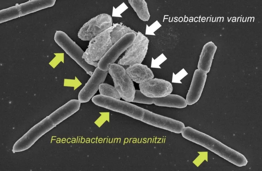 Helping Me, Hindering You: New Study Reveals Gut Microbial Power Struggle
