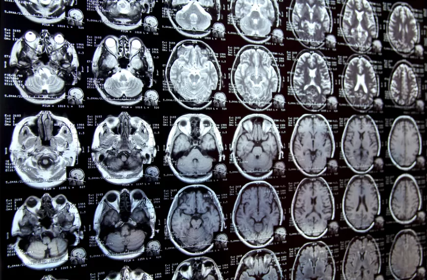 New AI system could accelerate clinical research