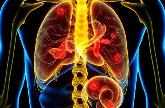 New Drug Shows Promise in Fighting Prostate Cancer 3 Prostate Cancer