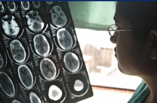 WHO Sounds Alarm on Global Neurological Health Crisis: Over 3 Billion Affected, Urgent Action Needed 3 neurology