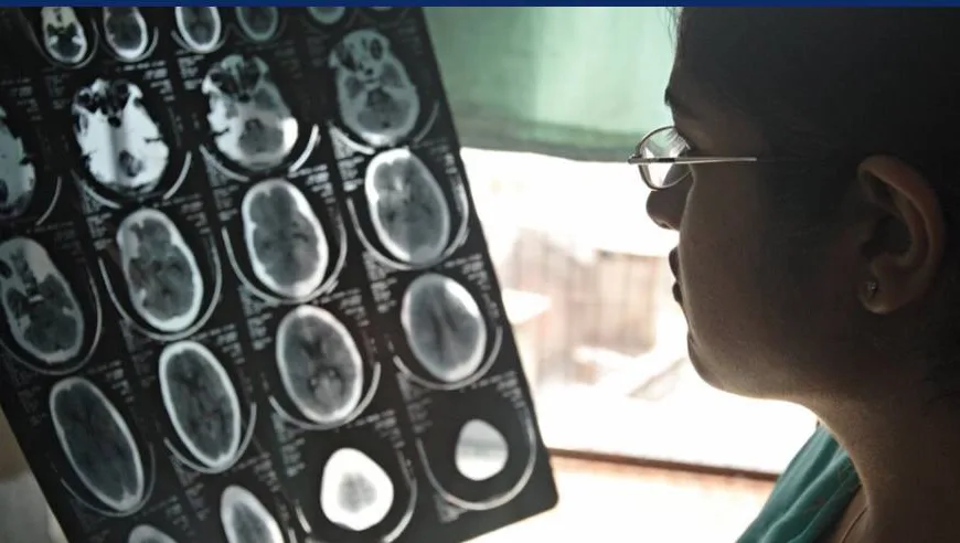 WHO Sounds Alarm on Global Neurological Health Crisis: Over 3 Billion Affected, Urgent Action Needed