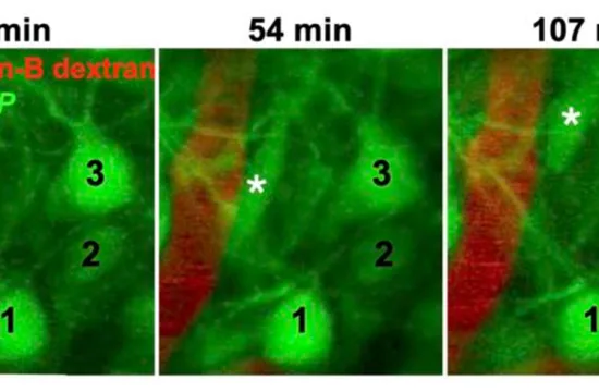 How neurons go with the blood flow when migrating through the brain 4 time laps image of migrating neuon