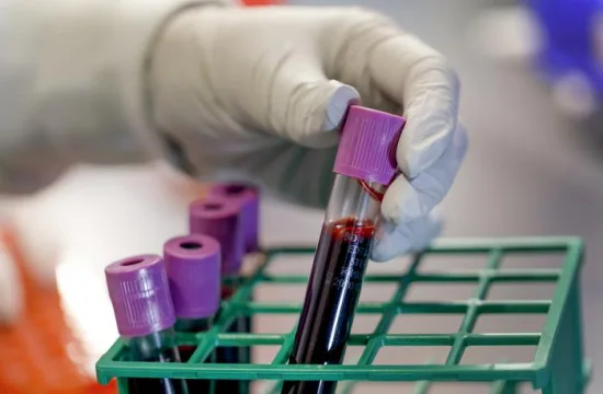 Researchers develop promising drug for aggressive breast cancer 3 Low Res Knight Cancer Institute blood research 1