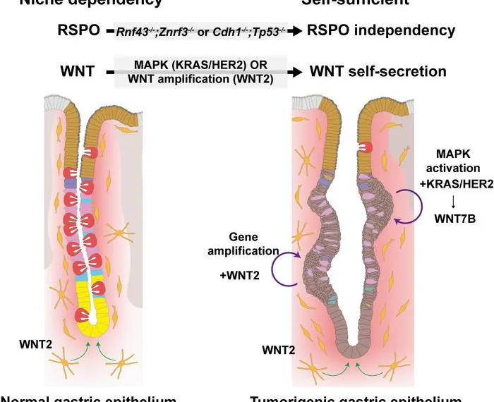 Researchers discover how stomach cancer learns to grow on its own