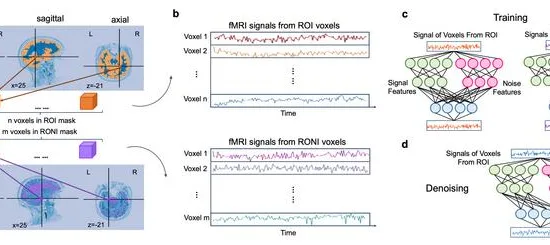 Artificial intelligence gives a clearer picture of functional MRI brain data 3 anzellotti.nature.methods
