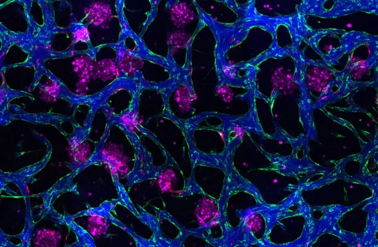 MIT liver model 01 press 0