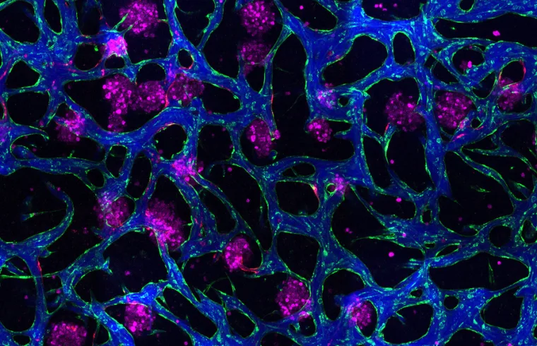 MIT liver model 01 press 0