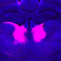 MIT Schizophrenia Beliefs 01 press 0