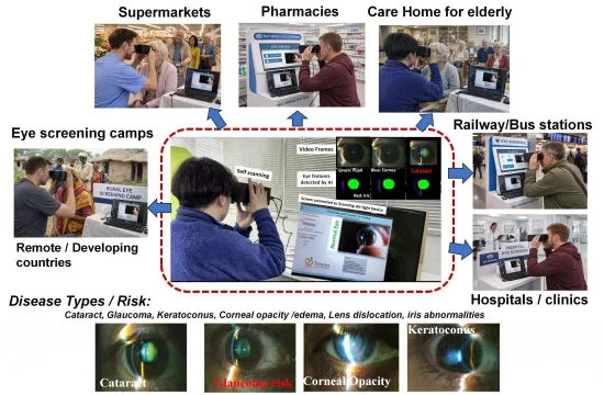 Researchers develop portable AI eye-scanning device for low-cost vision screening 3 Press release Figure