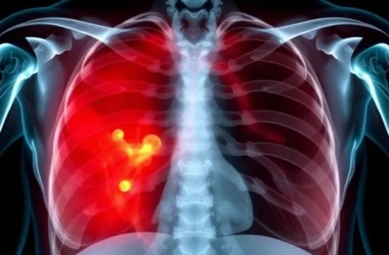 AI Chest X-Rays Reveal Hidden Osteoporosis Risks 3 ai chest